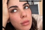 Алёна Опенченко: Развивается сахарный диабет...