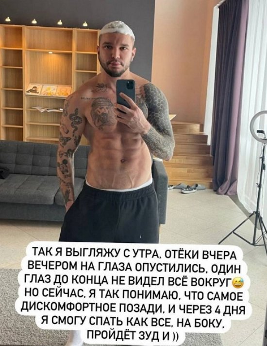 Антон Гусев: Чесать нельзя ещё пять дней