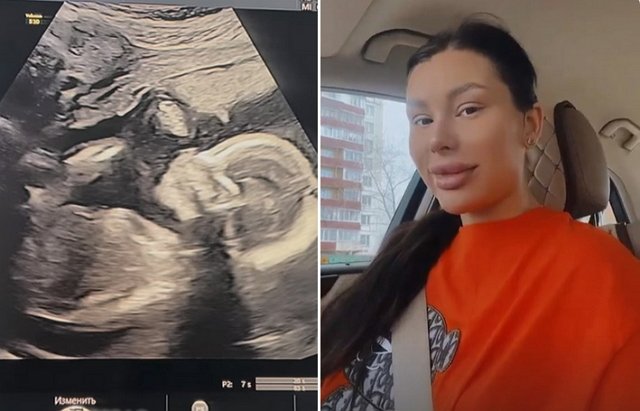 Алина Иордан: Самочувствие прекрасное! Алина Иордан: Самочувствие прекрасное!