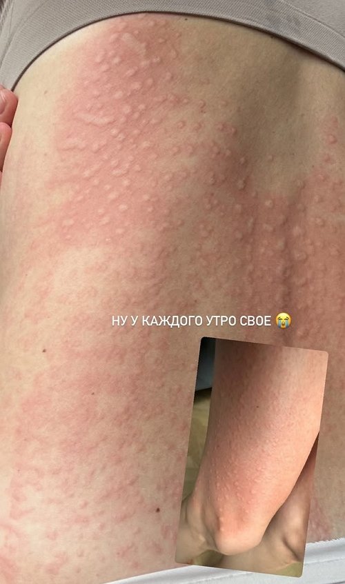 Александра Гозиас: У каждого своё утро
