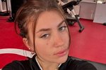 Катя Мысикова лечится от расстройства пищевого поведения