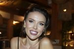 Фанаты Татьяны Строковой в ужасе от её загоревшего лица