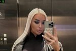 Анастасия Стецевят: 5 сутки у меня головные боли