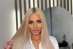 Анну Брянскую избил возлюбленный