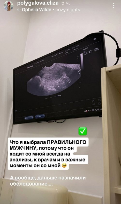 Лиза Полыгалова: УЗИ показало вот что...