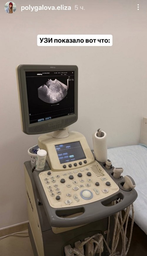 Лиза Полыгалова: УЗИ показало вот что...