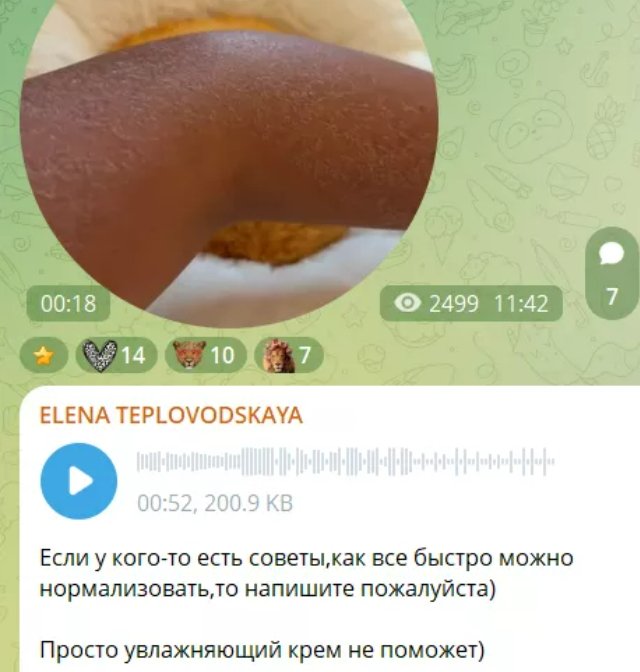 Елена Тепловодская может не попасть на важные съёмки