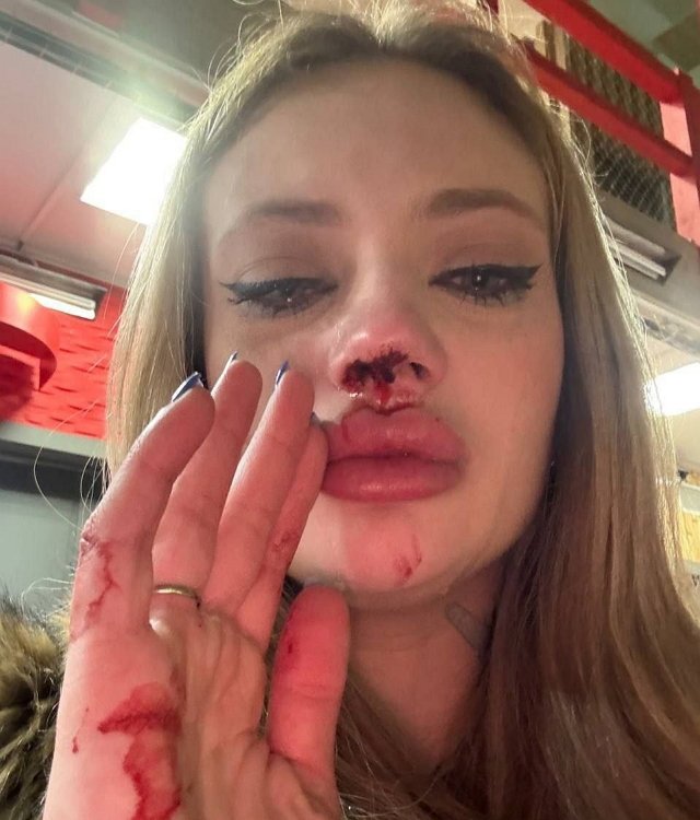 Ксения Карпова: Он поступил ужасно по отношению ко мне Ксения Карпова: Он поступил ужасно по отношению ко мне