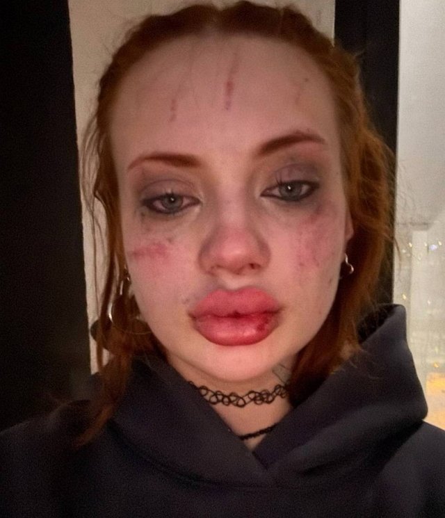 Ксения Карпова: Он поступил ужасно по отношению ко мне Ксения Карпова: Он поступил ужасно по отношению ко мне