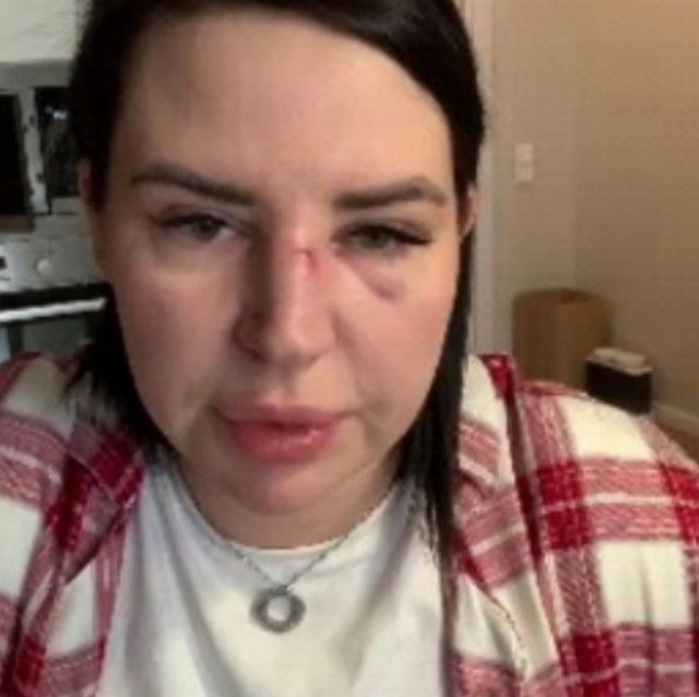 Хейтеры Александры Черно злорадствуют над её бедой Хейтеры Александры Черно злорадствуют над её бедой