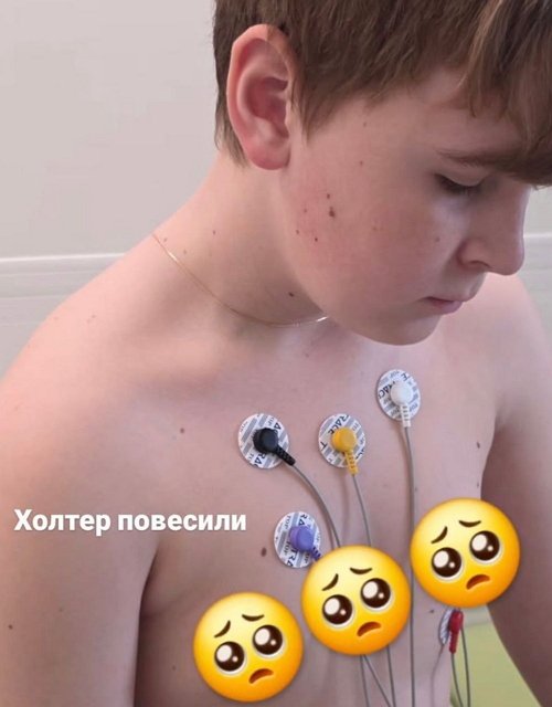 Ольга Ветер: На Мишу холтер повесили