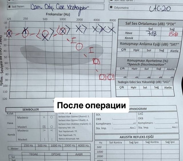 Рита Марсо: Я сразу побежала сдавать тест Рита Марсо: Я сразу побежала сдавать тест