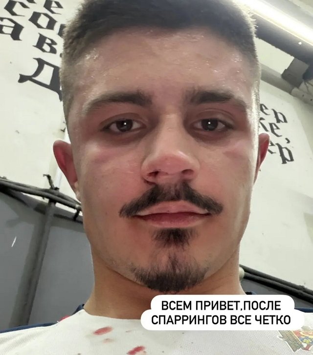 Никите Гуранда «пустили кровь» во время спарринга