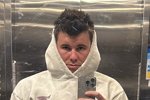 Сергей Хорошев лишился одного зуба