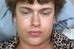 Егор Мельников: Губы у меня свои